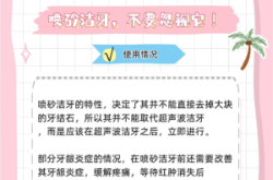 赤峰洗牙噴砂價格查詢電話號碼