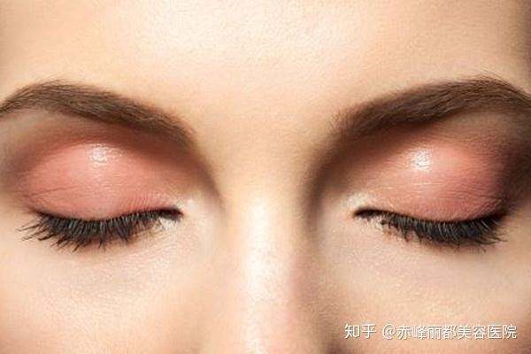 赤峰市雙眼皮醫(yī)院電話(huà)號(hào)碼-第1張圖片