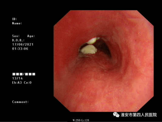 赤峰市支氣管鏡醫(yī)院電話號碼-第1張圖片