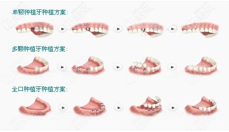 赤峰瑞美口腔醫(yī)院電話地址查詢-第1張圖片