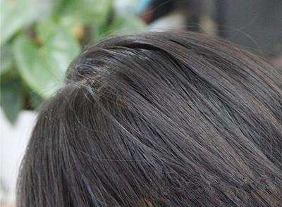 赤峰拔白發(fā)店電話號碼多少啊-第1張圖片