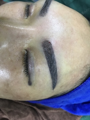 赤峰市眉毛種植基地電話號碼-第1張圖片