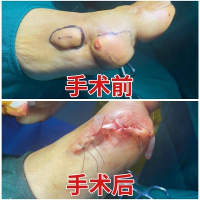 赤峰痛風(fēng)康復(fù)中心電話多少號(hào)-第1張圖片