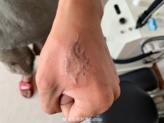 赤峰烏丹紋身店電話多少號-第1張圖片