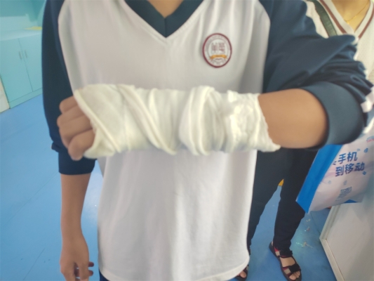 赤峰腕關節(jié)保護器公司電話地址-第1張圖片