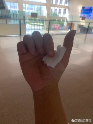 赤峰治療腱鞘炎電話是多少號(hào)-第1張圖片