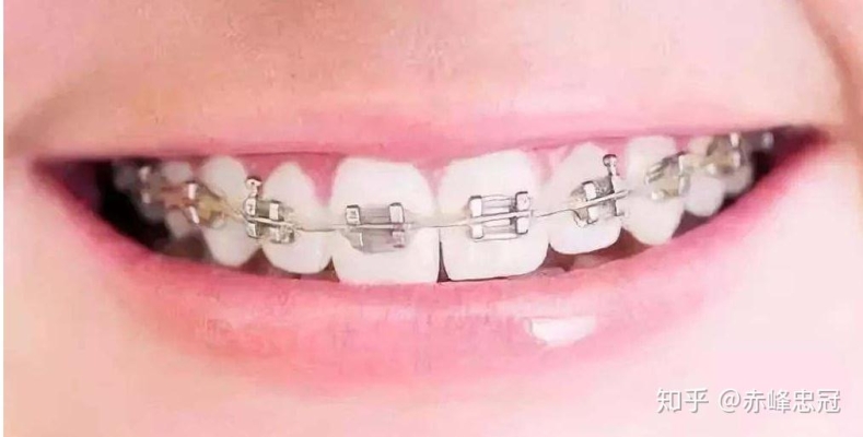 赤峰市忠冠口腔電話地址查詢-第1張圖片