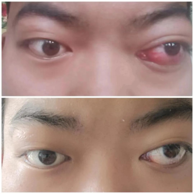 赤峰附屬醫(yī)院腦核磁預(yù)約電話號碼-第1張圖片