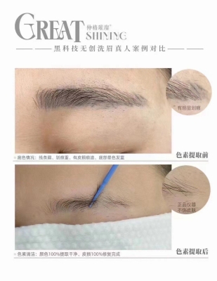 赤峰市無創(chuàng)洗眼線電話號碼-第1張圖片