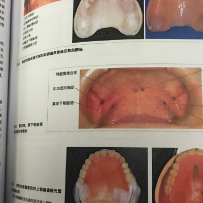 赤峰精翼義齒加工廠電話(huà)號(hào)碼-第1張圖片