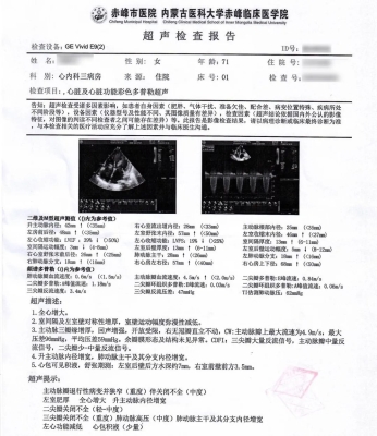 赤峰市超聲科電話是多少號(hào)-第1張圖片