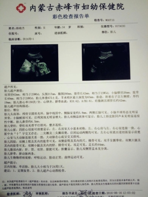 赤峰市婦幼產(chǎn)房電話號碼是多少-第1張圖片