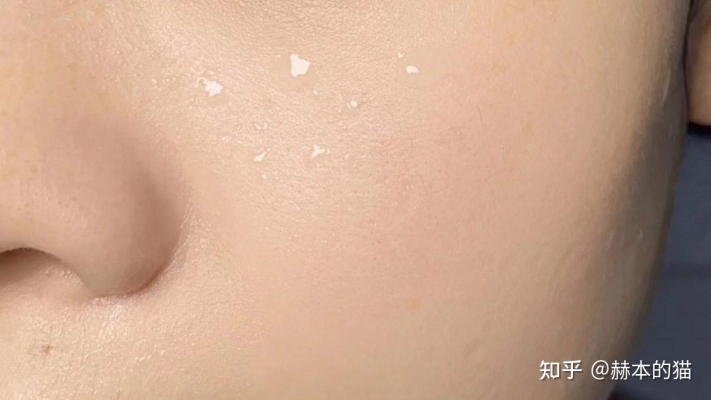 赤峰刷酸美容院地址電話號(hào)碼-第1張圖片