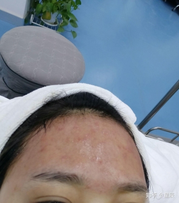 赤峰星辰醫(yī)美電話多少號碼啊-第1張圖片