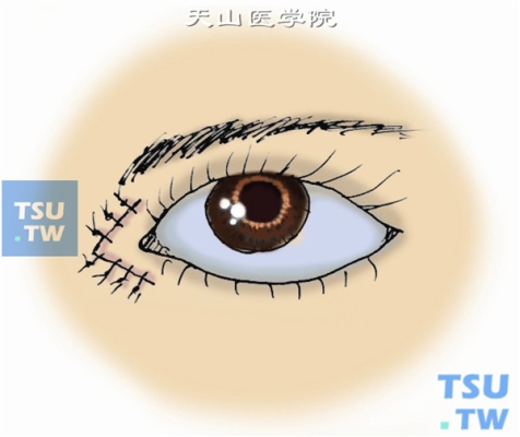 赤峰肌肉松解劑廠家電話號碼-第1張圖片