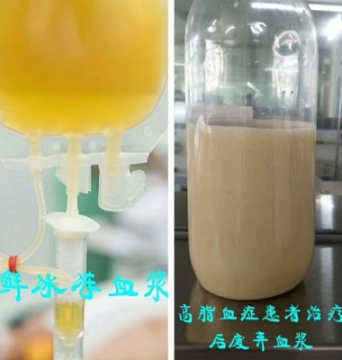 赤峰市醫(yī)院血漿機(jī)采購電話號碼-第1張圖片