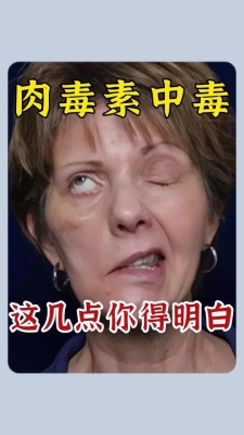 赤峰肉毒團(tuán)購電話號(hào)碼查詢-第1張圖片