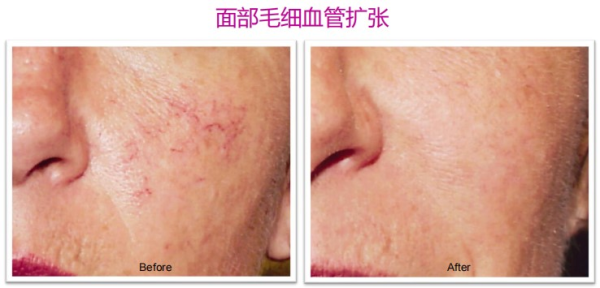 赤峰全身美白醫(yī)院電話號碼是多少-第1張圖片