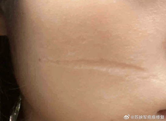 赤峰市無(wú)痕修復(fù)公司電話號(hào)碼-第1張圖片