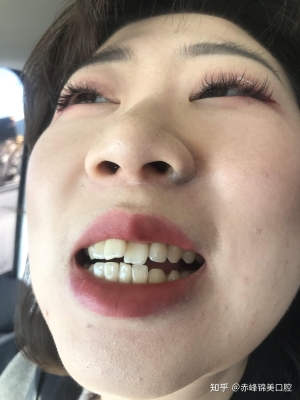 赤峰市招聘美牙師傅電話號碼-第1張圖片