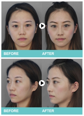 赤峰徒手面雕廠家電話地址查詢-第1張圖片