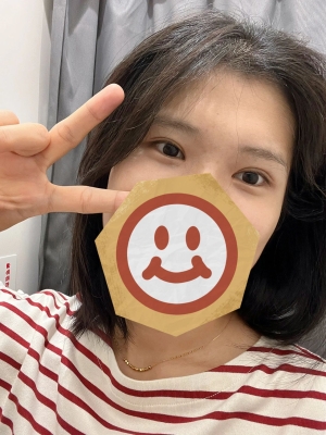 赤峰雙眼皮手術(shù)團購電話號碼-第1張圖片