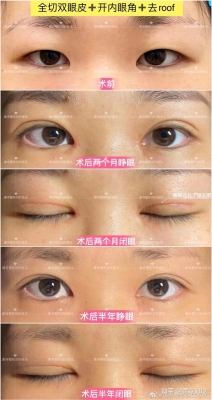 赤峰切眉美容院地址電話號碼-第1張圖片