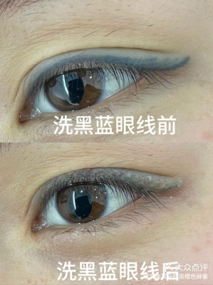 赤峰無創(chuàng)洗眼線電話號碼是多少-第1張圖片