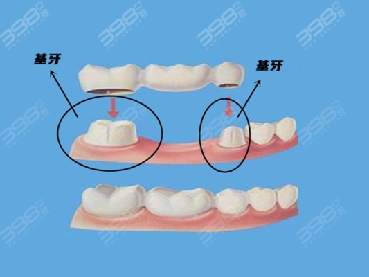 赤峰全瓷牙口腔醫(yī)院電話號(hào)碼-第1張圖片