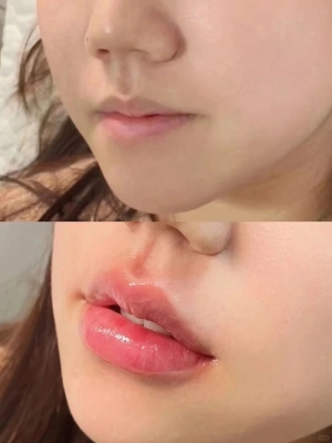 內(nèi)蒙古赤峰豐唇醫(yī)院電話號(hào)碼-第1張圖片