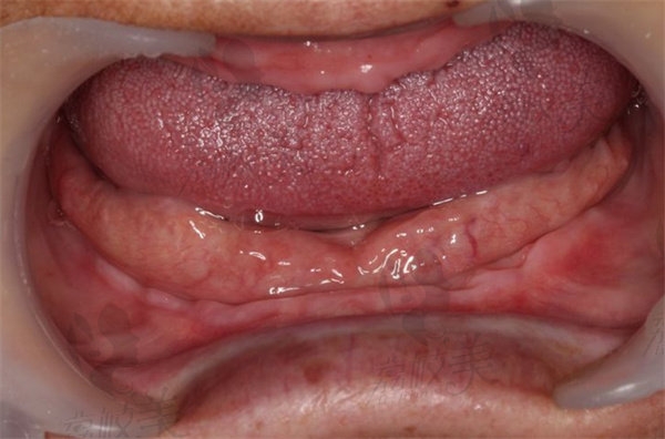 赤峰鑲活動(dòng)假牙醫(yī)院電話號(hào)碼-第1張圖片