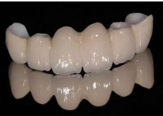 義齒加工廠赤峰地址電話號碼-第1張圖片