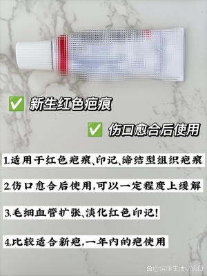 赤峰凹陷修復(fù)公司排名-第1張圖片