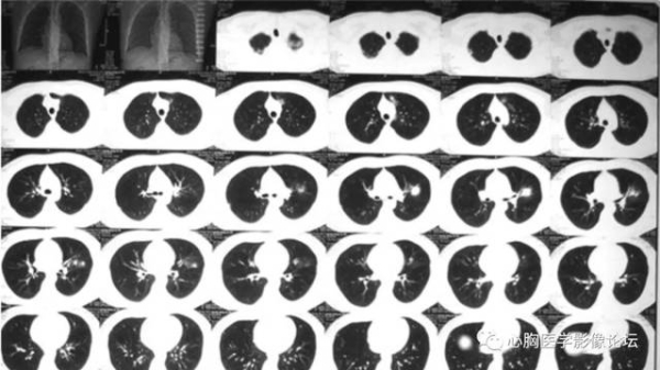 赤峰城東腫瘤醫(yī)院電話號碼-第1張圖片