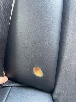 赤峰煙頭燙傷修復(fù)店電話號碼-第1張圖片