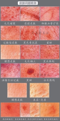 赤峰市皮膚檢測中心電話號碼-第1張圖片