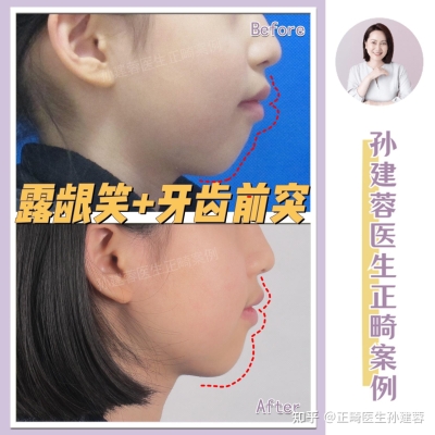 赤峰拔牙矯正醫(yī)院電話是多少號-第1張圖片