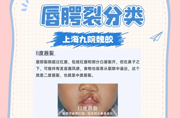 赤峰兔唇理發(fā)師電話地址查詢-第1張圖片