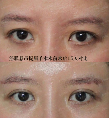 赤峰市陳剛中醫(yī)診所電話號(hào)碼-第1張圖片