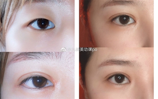 赤峰眉釘穿孔醫(yī)生名單電話號碼-第1張圖片