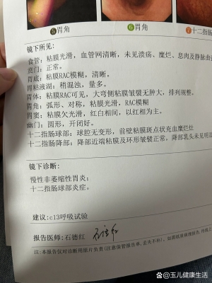 赤峰市預(yù)約胃鏡醫(yī)院電話號碼-第1張圖片