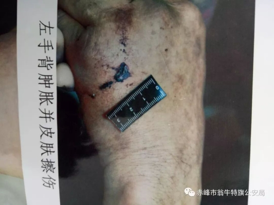 赤峰法醫(yī)鑒定平臺(tái)電話號(hào)碼-第1張圖片