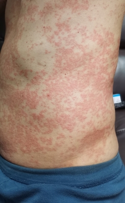 去赤峰化療求助電話號(hào)碼是多少-第1張圖片