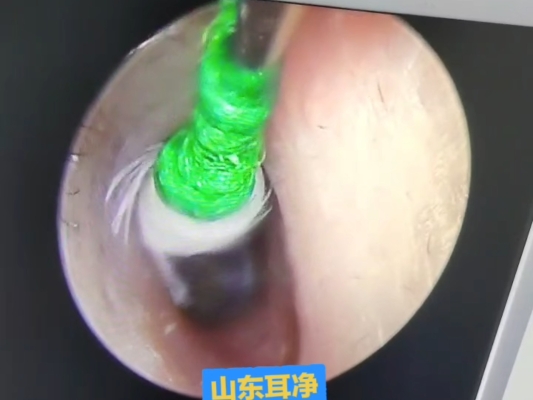 赤峰掏耳鏡維修電話號(hào)碼是多少-第1張圖片