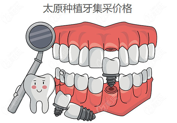赤峰種牙集采地址電話號(hào)碼-第1張圖片