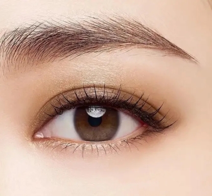 赤峰市雙眼皮-第1張圖片