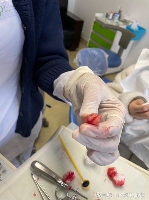 赤峰拔牙團(tuán)購(gòu)電話是多少號(hào)-第1張圖片