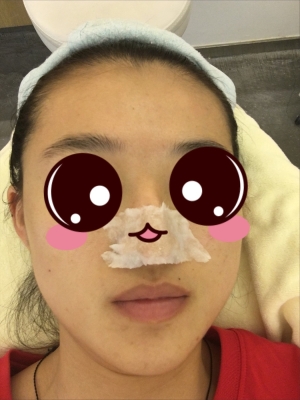 赤峰清潔黑頭團(tuán)購(gòu)電話地址是多少-第1張圖片