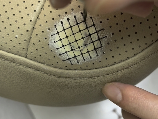 赤峰煙頭燙傷修復(fù)醫(yī)院電話號(hào)碼-第1張圖片