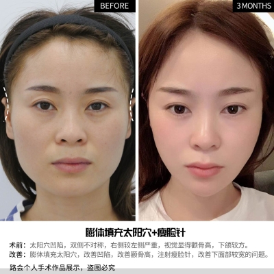 赤峰瘦臉團(tuán)購(gòu)電話地址查詢-第1張圖片